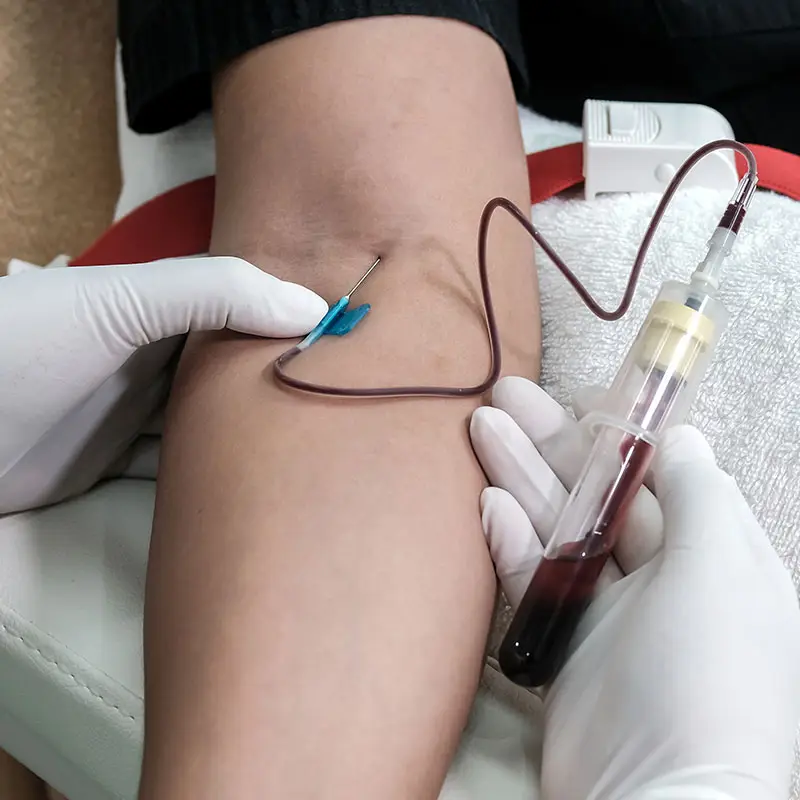 A closeup of a medical technician taking a blood sample from a young patient.